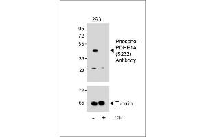 Western blot analysis of lysates from 293 cell line, untreated or treated with CIP, 100 ng/mL, using Phospho-PDHE1A Antibody (upper) or Tubulin (lower). (Pyruvate Dehydrogenase E1 alpha (pSer232) 抗体)