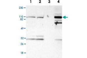 Western Blot analysis of Lane 1: RT-4, Lane 2: U-251MG sp, Lane 3: human plasma (IgG/HSA depleted) and Lane 4: human liver lysates with PYGL polyclonal antibody . (PYGL 抗体)