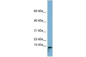 WB Suggested Anti-TCTA Antibody Titration:  0.