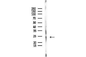 Western blot analysis of lysates from Mouse kidney, using TMEM126A Antibody at 1/1000 dilution. (TMEM126A 抗体)