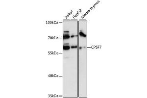 Western blot analysis of extracts of various cell lines, using CPSF7 antibody (ABIN6292490) at 1:3000 dilution. (CPSF7 抗体)