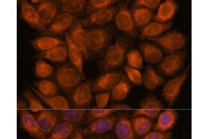 Immunofluorescence analysis of HeLa cells using SNX15 Polyclonal Antibody at dilution of 1:100. (SNX15 抗体)