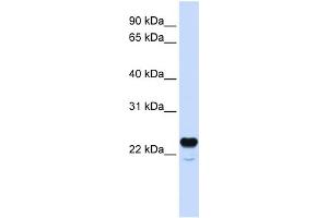 WB Suggested Anti-C1QTNF1 Antibody Titration:  0. (C1QTNF1 抗体  (N-Term))