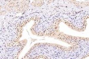 Immunohistochemistry (Paraffin-embedded Sections) (IHC (p)) image for anti-Nudix (Nucleoside Diphosphate Linked Moiety X)-Type Motif 22 (NUDT22) antibody (ABIN7074928)