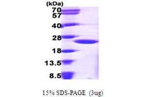 ARF1 Protein (AA 1-181) (His tag)
