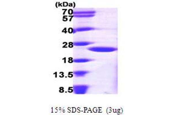 ARF1 Protein (AA 1-181) (His tag)