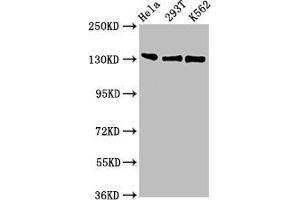 Western Blot Positive WB detected in: Hela whole cell lysate, 293T whole cell lysate, K562 whole cell lysate All lanes: RFX1 antibody at 3 μg/mL Secondary Goat polyclonal to rabbit IgG at 1/50000 dilution Predicted band size: 105 kDa Observed band size: 105 kDa (RFX1 抗体  (AA 36-133))