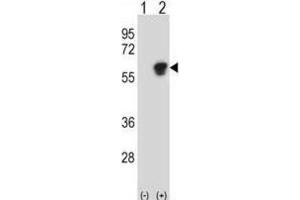 Western Blotting (WB) image for anti-Nucleosome Assembly Protein 1-Like 1 (NAP1L1) antibody (ABIN3000775) (NAP1L1 抗体)