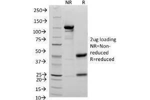 SDS-PAGE Analysis Purified CD48 Mouse Monoclonal Antibody (156-4H9). (CD48 抗体)