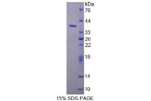 SDS-PAGE analysis of Human PURA Protein. (PURA 蛋白)