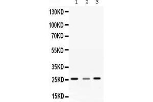 Western blot analysis of SRI expression in rat liver extract ( Lane 1), rat brain extract ( Lane 2) and SMMC7721 whole cell lysates ( Lane 3). (SRI 抗体  (Middle Region))