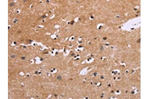 The image on the left is immunohistochemistry of paraffin-embedded Human brain tissue using ABIN7190535(EGR4 Antibody) at dilution 1/20, on the right is treated with synthetic peptide. (EGR4 抗体)