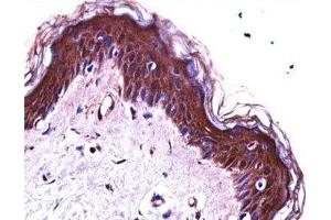 S100A7 antibody immunohistochemistry analysis in formalin fixed and paraffin embedded human skin tissue. (S100A7 抗体  (AA 2-31))