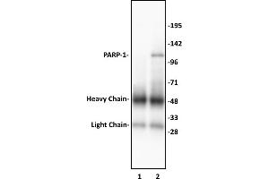 PARP-1 N-terminal antibody (pAb) tested by Immunoprecipitation. (PARP1 抗体  (N-Term))