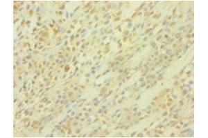 Immunohistochemistry (IHC) image for anti-Protein Interacting With Protein Kinase C, alpha 1 (PICK1) (AA 1-200) antibody (ABIN7164283)