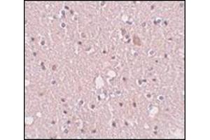 Immunohistochemistry of SIPA1L2 in human brain tissue with this product at 5 μg/ml. (SIPA1L2 抗体  (N-Term))