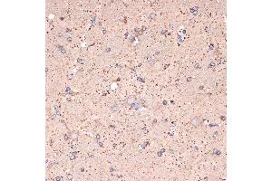 Immunohistochemistry of paraffin-embedded rat brain using GABA transaminase (GABA transaminase (ABAT)) Rabbit mAb (ABIN7265336) at dilution of 1:100 (40x lens). (ABAT 抗体)