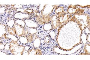 Detection of RNASE3 in Human Kidney Tissue using Polyclonal Antibody to Ribonuclease A3 (RNASE3) (RNASE3 抗体  (AA 30-154))