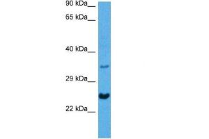 Host:  Mouse  Target Name:  NKX2-5  Sample Tissue:  Mouse Heart  Antibody Dilution:  1ug/ml (NK2 Homeobox 5 抗体  (N-Term))