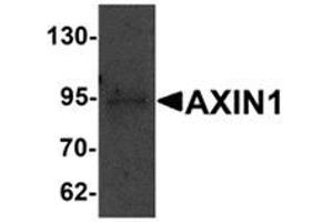 Western blot analysis of AXIN1 in SK-N-SH cell lysate with AXIN1 antibody at 1 μg/ml. (Axin 抗体  (C-Term))