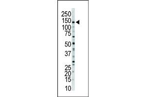 Western blot analysis of anti-MLCK-long Pab (ABIN392495 and ABIN2842065) in mouse brain tissue lysate. (MYLK 抗体  (N-Term))