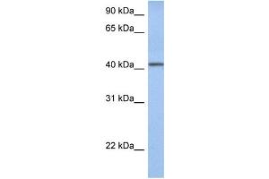WB Suggested Anti-YIPF1 Antibody Titration:  0. (YIPF1 抗体  (Middle Region))