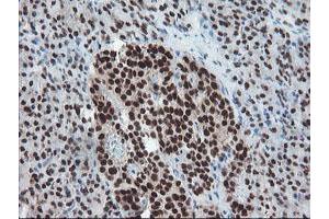 Image no. 11 for anti-TP53RK Binding Protein (TPRKB) antibody (ABIN1501484)