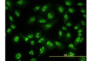 Image no. 2 for anti-Adrenocortical Dysplasia Homolog (ACD) (AA 1-545) antibody (ABIN599297) (ACD 抗体  (AA 1-545))