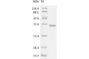 (Tris-Glycine gel) Discontinuous SDS-PAGE (reduced) with 5 % enrichment gel and 15 % separation gel.