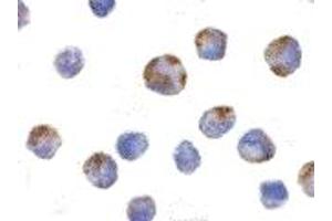 Immunohistochemistry (IHC) image for anti-NLR Family, Pyrin Domain Containing 1 (NLRP1) (C-Term) antibody (ABIN1030530) (NLRP1 抗体  (C-Term))