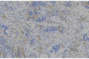 ABIN6279516 at 1/100 staining Human lymph node tissue by IHC-P. (LILRB2 抗体)