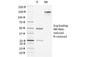 SDS-PAGE Analysis of Purified, BSA-Free vWF Antibody (clone VWF/1465). (VWF 抗体  (AA 1815-1939))