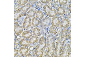 Immunohistochemistry of paraffin-embedded mouse kidney using AP2A1 Antibody (ABIN5975765) at dilution of 1/100 (40x lens). (alpha Adaptin 抗体)