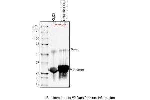 Sample Type: Purified Recombinant CLIC-1 proteinPrimary Dilution: 1:1000 (CLIC1 抗体  (C-Term))