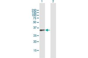 Western Blot analysis of BCAT1 expression in transfected 293T cell line by BCAT1 MaxPab polyclonal antibody. (BCAT1 抗体  (AA 1-320))