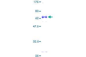 DLX5 Protein (AA 1-289) (GST tag)