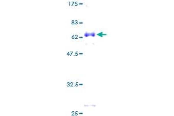 DLX5 Protein (AA 1-289) (GST tag)