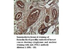 Image no. 2 for anti-Mitogen-Activated Protein Kinase 8 (MAPK8) antibody (ABIN790900) (JNK 抗体)
