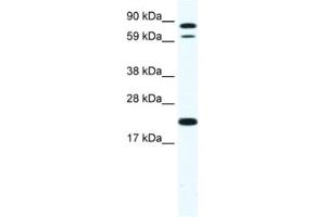 Western Blotting (WB) image for anti-Zinc Finger Protein 287 (ZNF287) antibody (ABIN2461531) (ZNF287 抗体)