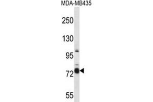 Western Blotting (WB) image for anti-Cas Scaffolding Protein Family Member 4 (CASS4) antibody (ABIN2997369) (CASS4 抗体)