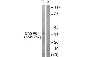 Immunohistochemistry analysis of paraffin-embedded human colon carcinoma tissue using Caspase 6 (Phospho-Ser257) antibody. (Caspase 6 抗体  (pSer257))