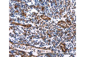 Immunohistochemistry of Human tonsil using DUSP6 Polyclonal Antibody at dilution of 1:25 (DUSP6 抗体)