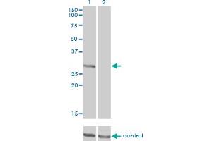 Western blot analysis of FCER1A over-expressed 293 cell line, cotransfected with FCER1A Validated Chimera RNAi (Lane 2) or non-transfected control (Lane 1). (Fc epsilon RI/FCER1A 抗体  (AA 1-257))