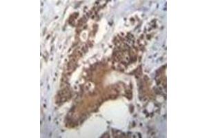 anti-Phosphate Cytidylyltransferase 1, Choline, alpha (PCYT1A) (AA 34-62), (N-Term) antibody