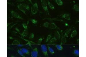 Immunofluorescence analysis of U-2 OS cells using GLUD1 Polyclonal Antibody at dilution of 1:100. (GLUD1 抗体)
