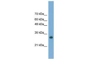 WB Suggested Anti-FAM78A Antibody Titration: 0. (FAM78A 抗体  (C-Term))