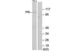 Western blot analysis of extracts from HeLa cells, using Progesterone Receptor (Ab-400) Antibody. (Progesterone Receptor 抗体  (AA 371-420))