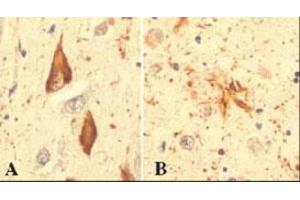 Immunohistochemical staining of RPS27A in hippocampal tissue from an Alzheimer patient, using RPS27A monoclonal antibody, clone Ubi-1 . (RPS27A 抗体)