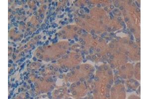 Detection of TMEM27 in Mouse Kidney Tissue using Polyclonal Antibody to Transmembrane Protein 27 (TMEM27)