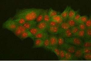 IF analysis of HMGB2 and Tubulin alpha using anti-HMGB2 antibody (ABIN4886620) and anti-Tubulin alpha antibody (ABIN7600339). (HMGB2 抗体  (N-Term))